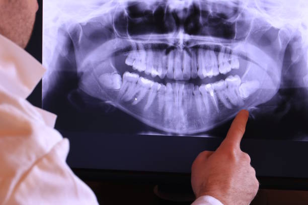 Best Dentist for Tooth Abscess  in Stockton, CA