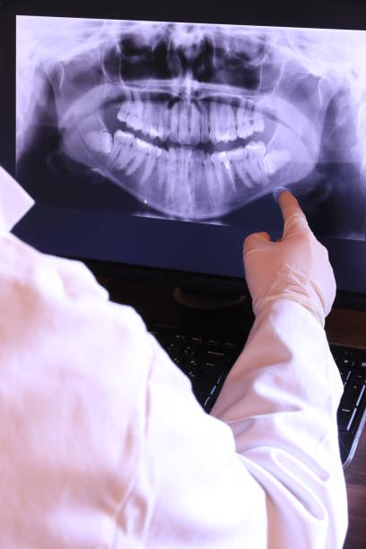 Best Broken Tooth Emergency  in Stockton, CA